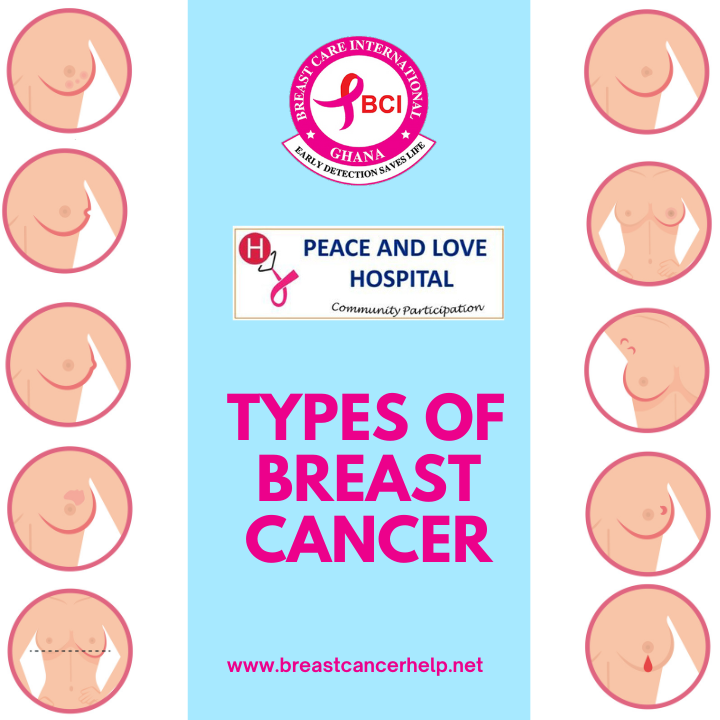 Types_of_Breast_Cancer